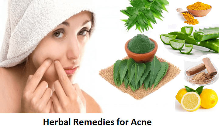 Herbal Remedies for Acne