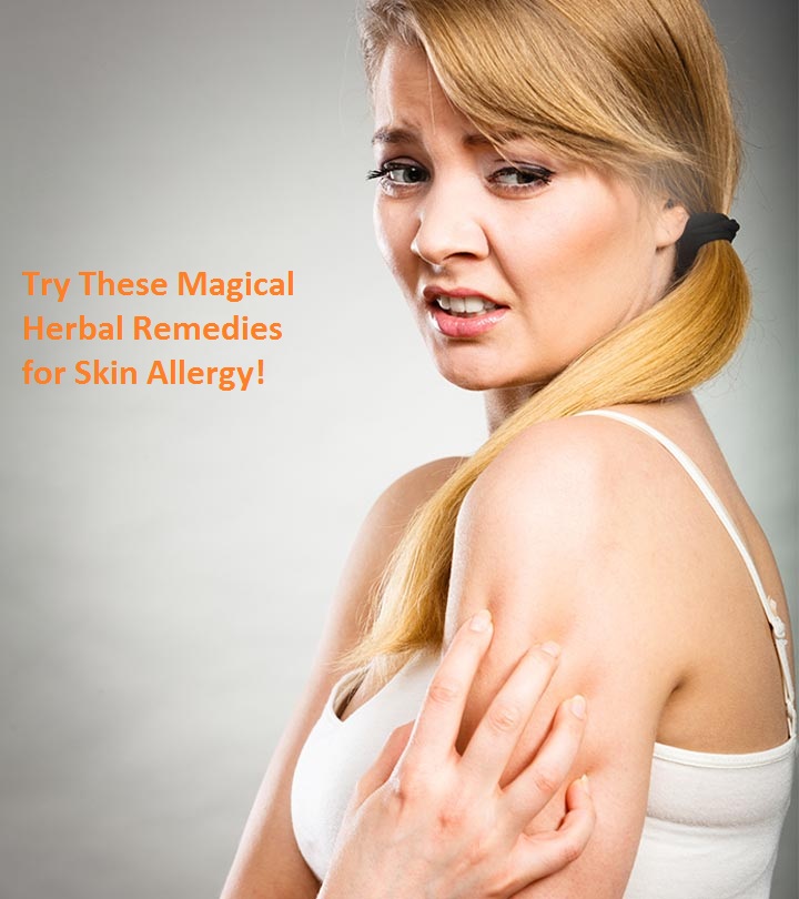 Try These Magical Herbal Remedies for Skin Allergy!