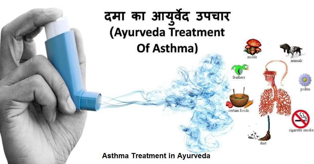 Asthma Treatment in Ayurveda