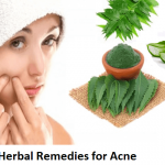 Herbal Remedies for Acne