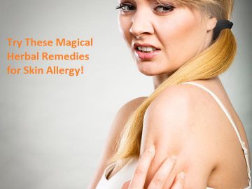 Try These Magical Herbal Remedies for Skin Allergy!