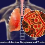 Coronavirus Infection Symptoms and Treatment
