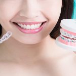 Choosing An Invisalign Orthodontist
